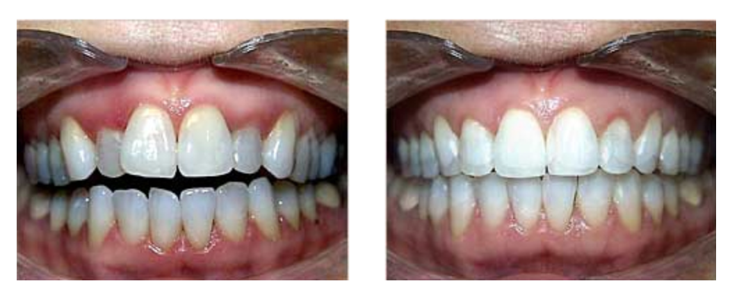 Priore Odontologia Ortodontia